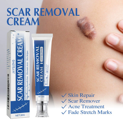 🔥Last Day Discount 49% Off🔥Professional Scar Removal Gel,Smooth & Firm Skin, Reduce Wrinkles-FO