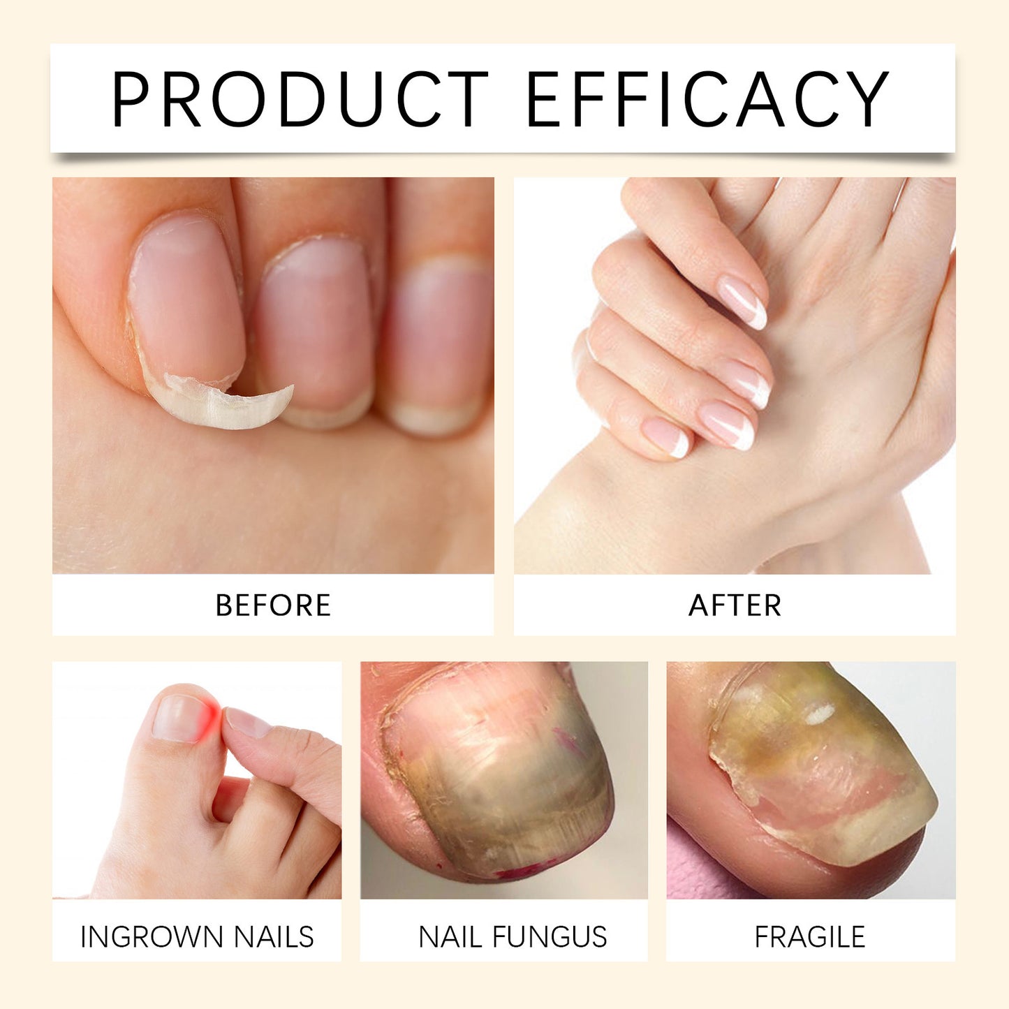 🔥Last Day Discount 49% Off🔥Houkea Nail Serum-FO