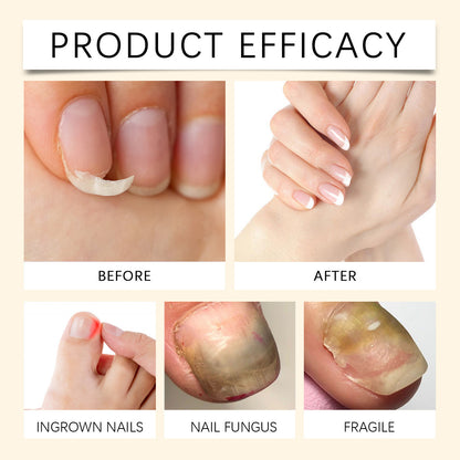 🔥Last Day Discount 49% Off🔥Houkea Nail Serum-FO
