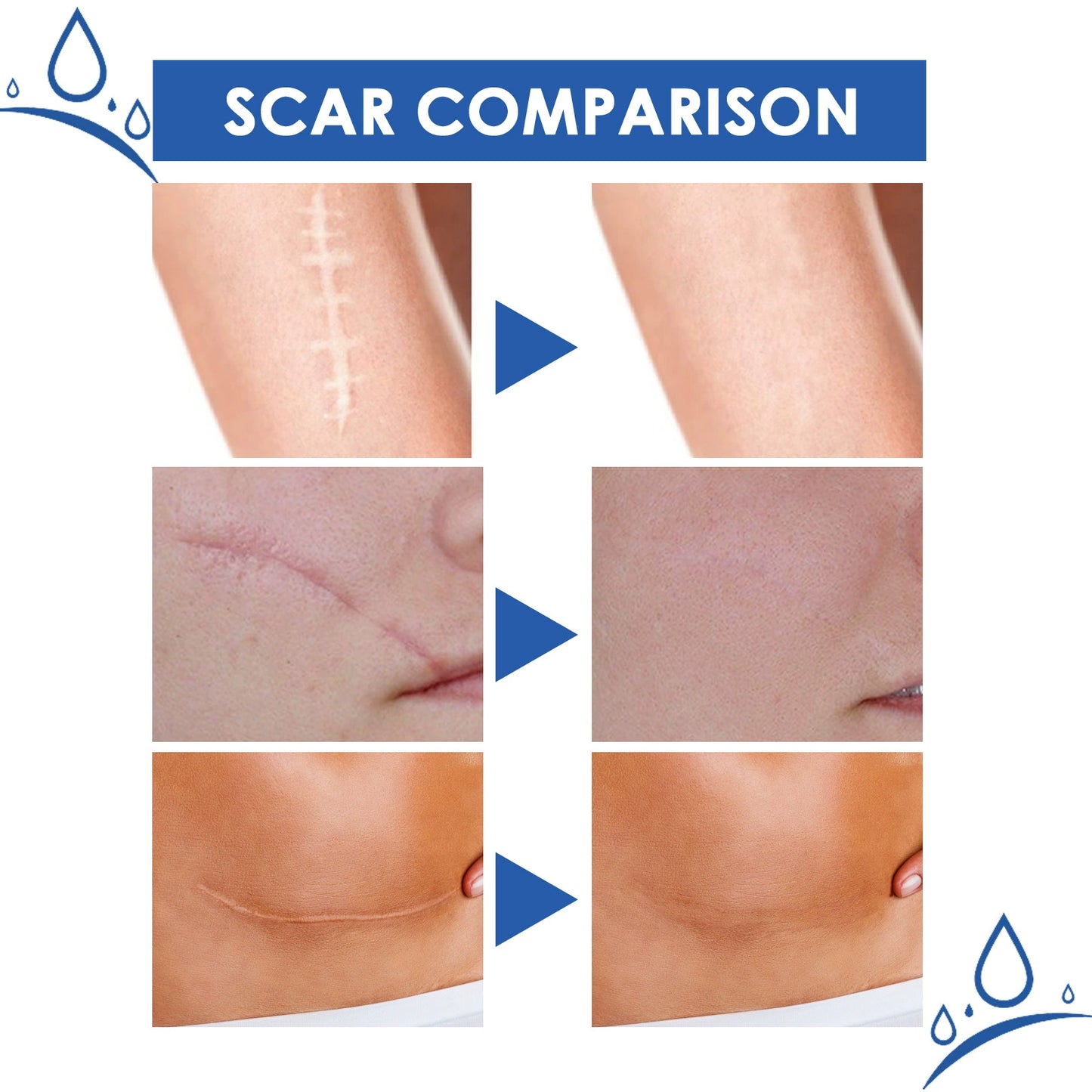 🔥Last Day Discount 49% Off🔥Professional Scar Removal Gel,Smooth & Firm Skin, Reduce Wrinkles-FO