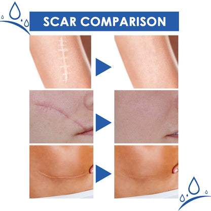 🔥Last Day Discount 49% Off🔥Professional Scar Removal Gel,Smooth & Firm Skin, Reduce Wrinkles-FO