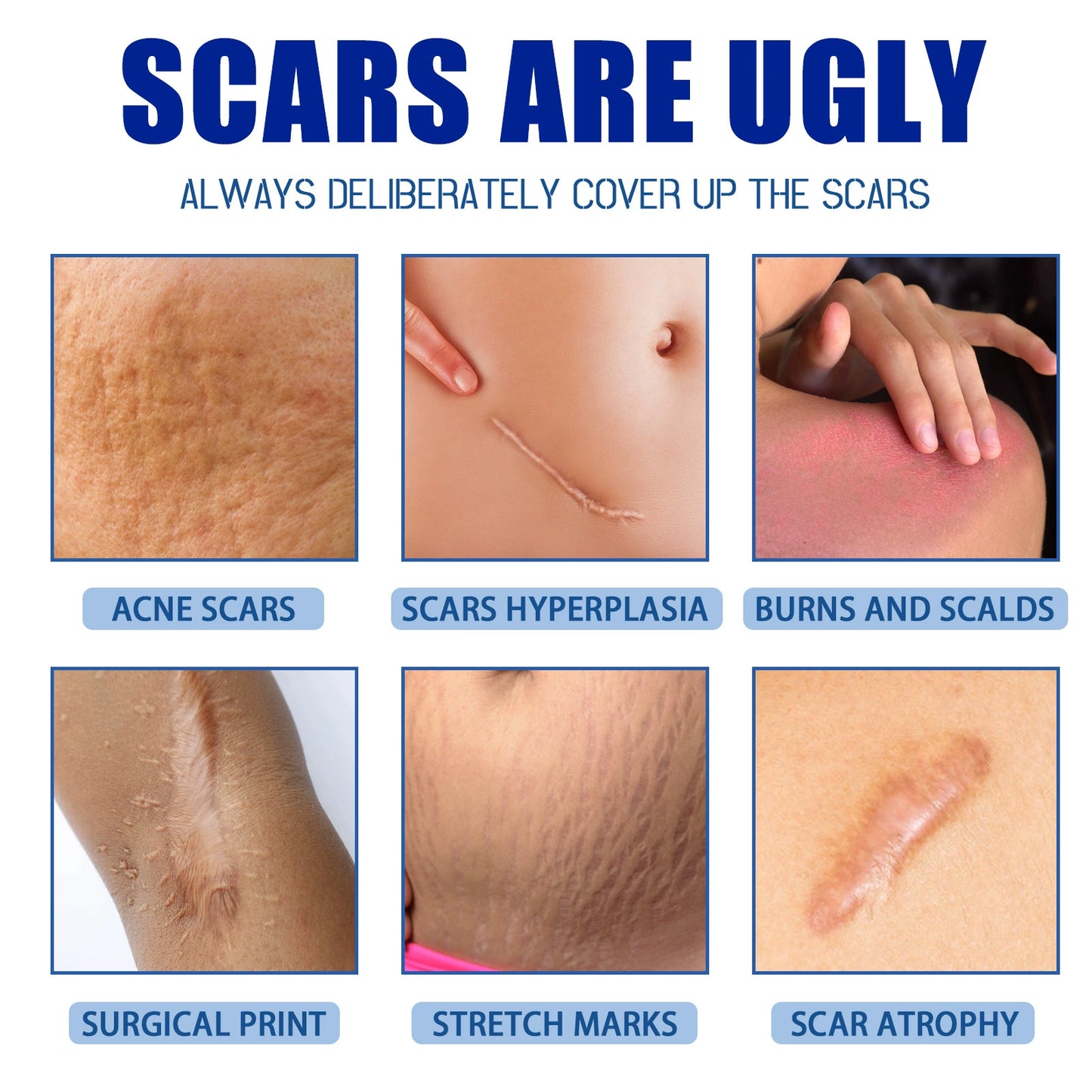 🔥Last Day Discount 49% Off🔥Professional Scar Removal Gel,Smooth & Firm Skin, Reduce Wrinkles-FO