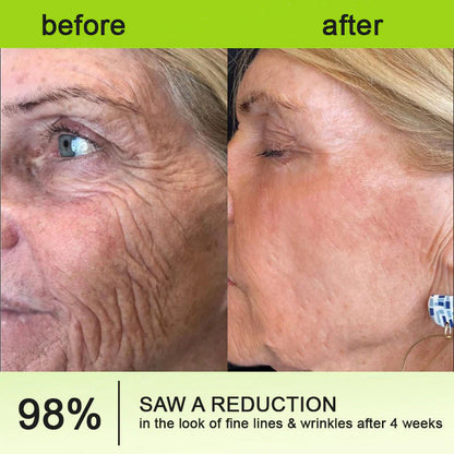 🔥Final 3 Hours: 70%OFF🔥 Botulinum & Vita-A Retinol Shot Wrinkle-Lift Tightening cream✨-EV