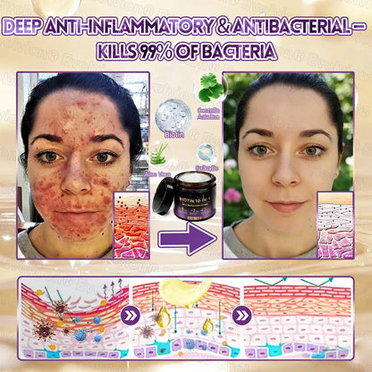 🏆 Sold Out 3 Times This Month! 10-in-1 Skin Restoration Cream 🌙-TY