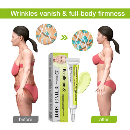 🔥Final 3 Hours: 70%OFF🔥 Botulinum & Vita-A Retinol Shot Wrinkle-Lift Tightening cream✨-EV