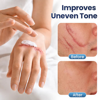 🏆 Award-Winning Quality ⚡ 900K+ SOLD!| 💎Premium Clinical-Grade Texture Repair Gel -KKK