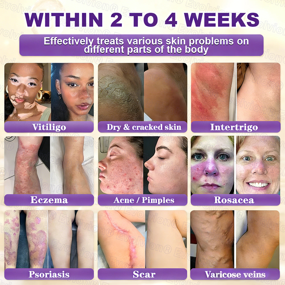 🏆 Sold Out 3 Times This Month! 10-in-1 Skin Restoration Cream 🌙-TY