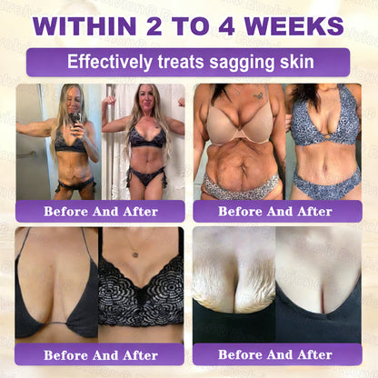 🏆 Sold Out 3 Times This Month! 10-in-1 Skin Restoration Cream 🌙-TY