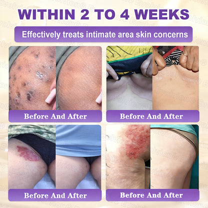 🏆 Sold Out 3 Times This Month! 10-in-1 Skin Restoration Cream 🌙-TY
