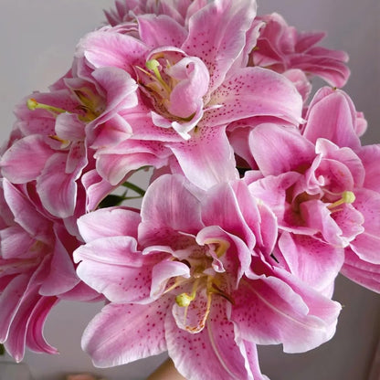 🏆Flash Sale⚡ 90K+ SOLD!-🌸Rare Lily Bulbs |✨50-Year Shelf Life -KKK