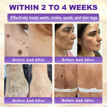 🏆 Sold Out 3 Times This Month! 10-in-1 Skin Restoration Cream 🌙-TY