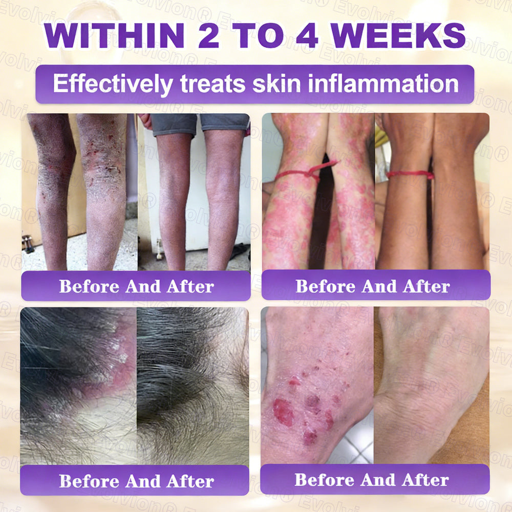 🏆 Sold Out 3 Times This Month! 10-in-1 Skin Restoration Cream 🌙-TY