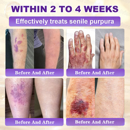🏆 Sold Out 3 Times This Month! 10-in-1 Skin Restoration Cream 🌙-TY