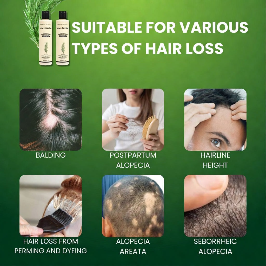 🔥Final 3 Hours: 70%OFF🔥 Rosemary Hydrolyzed Keratin Shampoo-EV