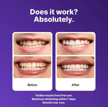 🦷7D Wisdom Tooth Whitening – Gentle, effective dental care with sea salt for bright white teeth 💎-EV