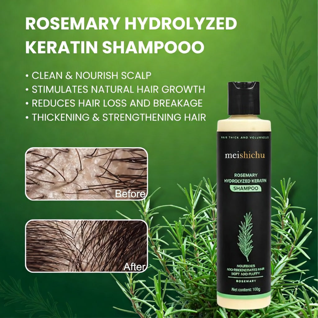 🔥Final 3 Hours: 70%OFF🔥 Rosemary Hydrolyzed Keratin Shampoo-EV