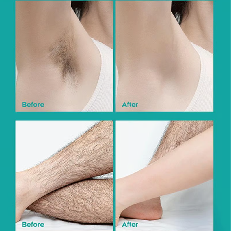 🌞 Painless Full Body Hair Removal Cream for Men & Women– Skin-friendly for all areas-ZZZ