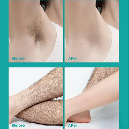 🌞 Painless Full Body Hair Removal Cream for Men & Women– Skin-friendly for all areas-ZZZ