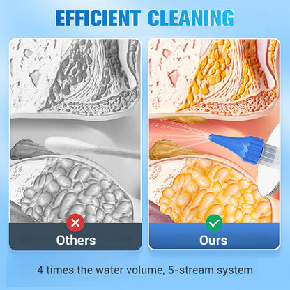 🏆Flash Sale⚡ 50K+ SOLD!-Ear Wax Removal Kit – Safe & Gentle, Reusable Silicone Spoon, Easy to Use, Effective & Hygienic for Ear Cleaning ✨-EV